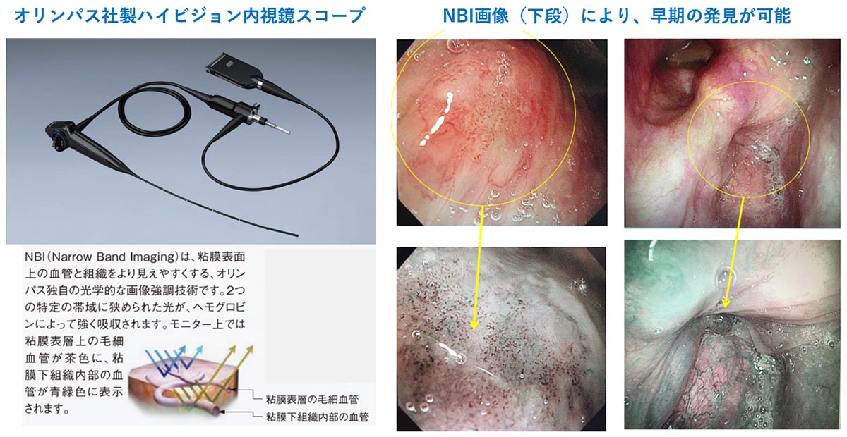 ハイビジョン内視鏡スコープ