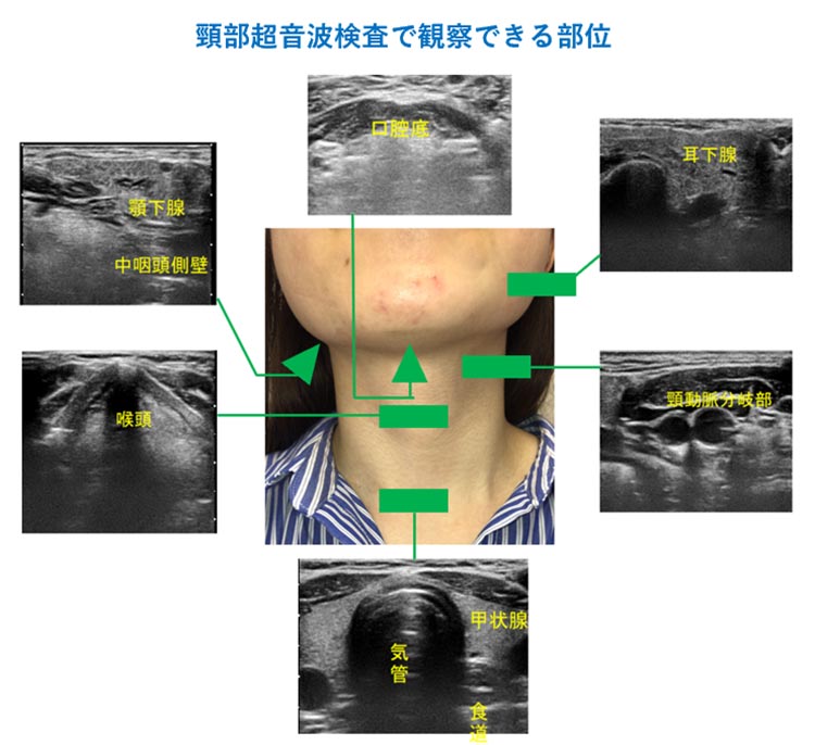 頸部超音波検査で観察できる部位