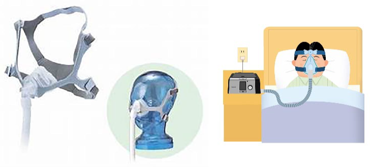CPAP治療